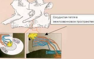 Дискоспондилез у котов